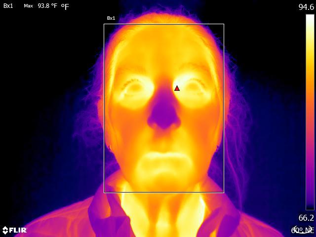 FLIR body temperature scan corner of eye