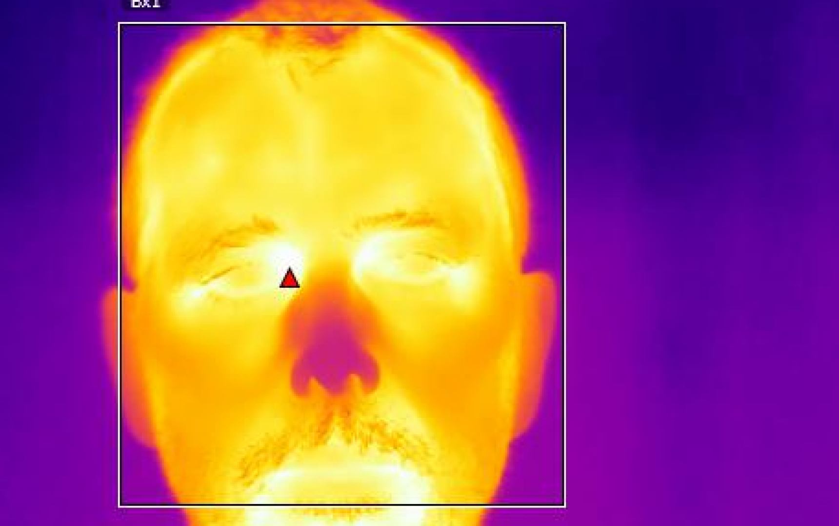 Thermal Body Temperature Scanning by Infrared Diagnostic in Sudbury, Massachusetts Image of Thermal Body Temperature Scanning by Infrared Diagnostic in Sudbury, Massachusetts